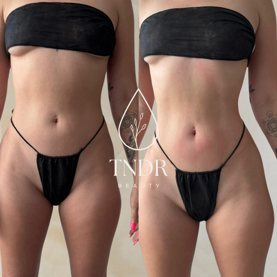 Client after 1 Session Client after 1 Session